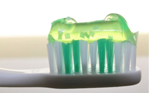 歯列矯正中の虫歯予防に有効なフッ素の使い方