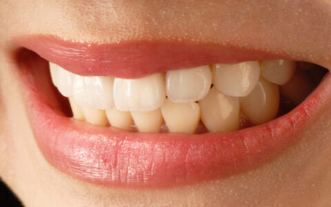 子どもの歯と歯の間に隙間がある…矯正は必要？