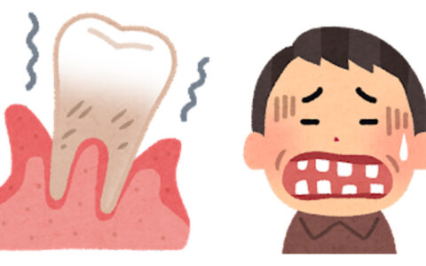 歯を失うとどうなる？