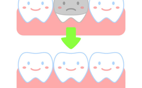 銀歯からセラミックにできるの？