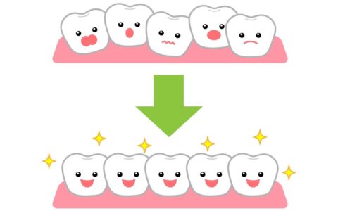 歯列矯正に年齢制限はある？