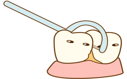 歯周病はどこまで回復する？