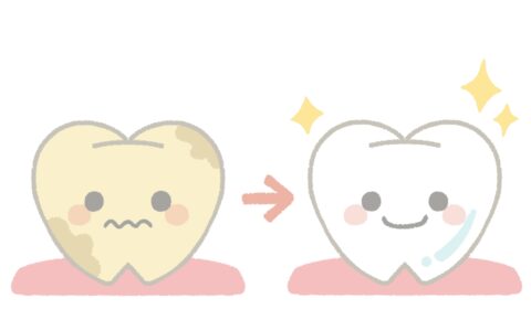 歯を白くするってどういうこと？ホワイトニングの仕組みと安全性