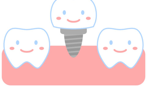 🦷インプラント治療とは？〜噛める喜びを取り戻す選択肢〜