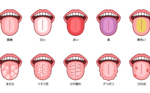 舌の色でわかる体調のサイン