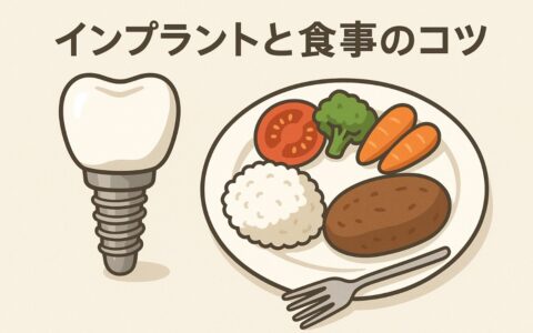 インプラントを快適に使うための食事と噛み方
