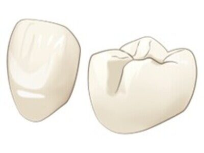 きれいで強いセラミック