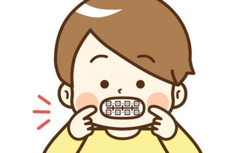 矯正っていつからするの？