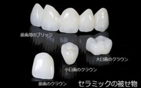 自然で美しい歯に ― セラミック治療という選択肢 ―