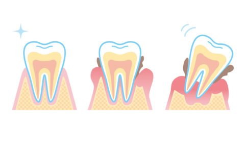 将来のために始める歯ぐきケア